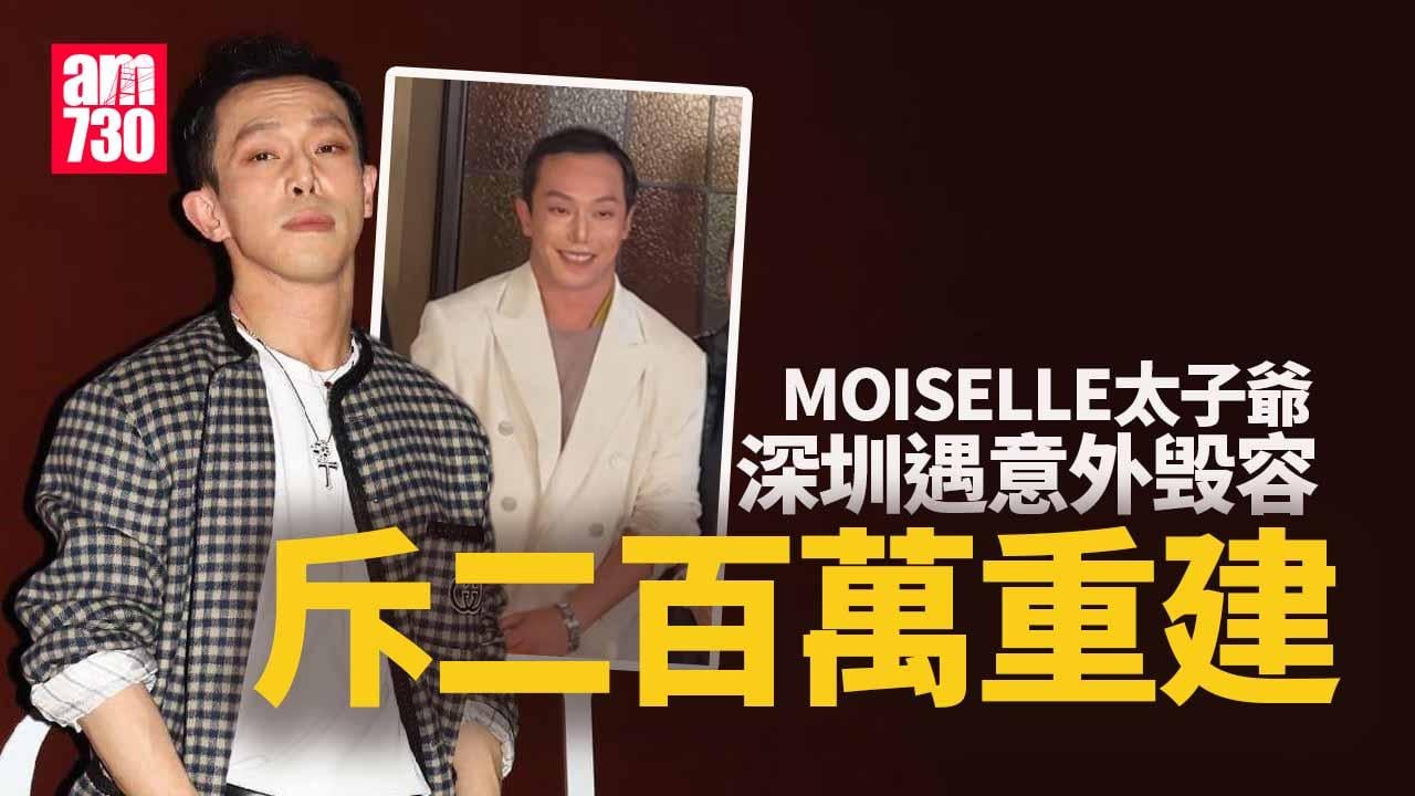 陳柏熹遇意外毁容 斥200萬重建後公開現身慶祝38歲生日