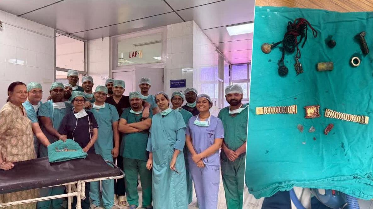 醫療團隊進行長達3小時的緊急微創手術，替男子取出卡食道的手錶和腸道裡的異物。(互聯網)