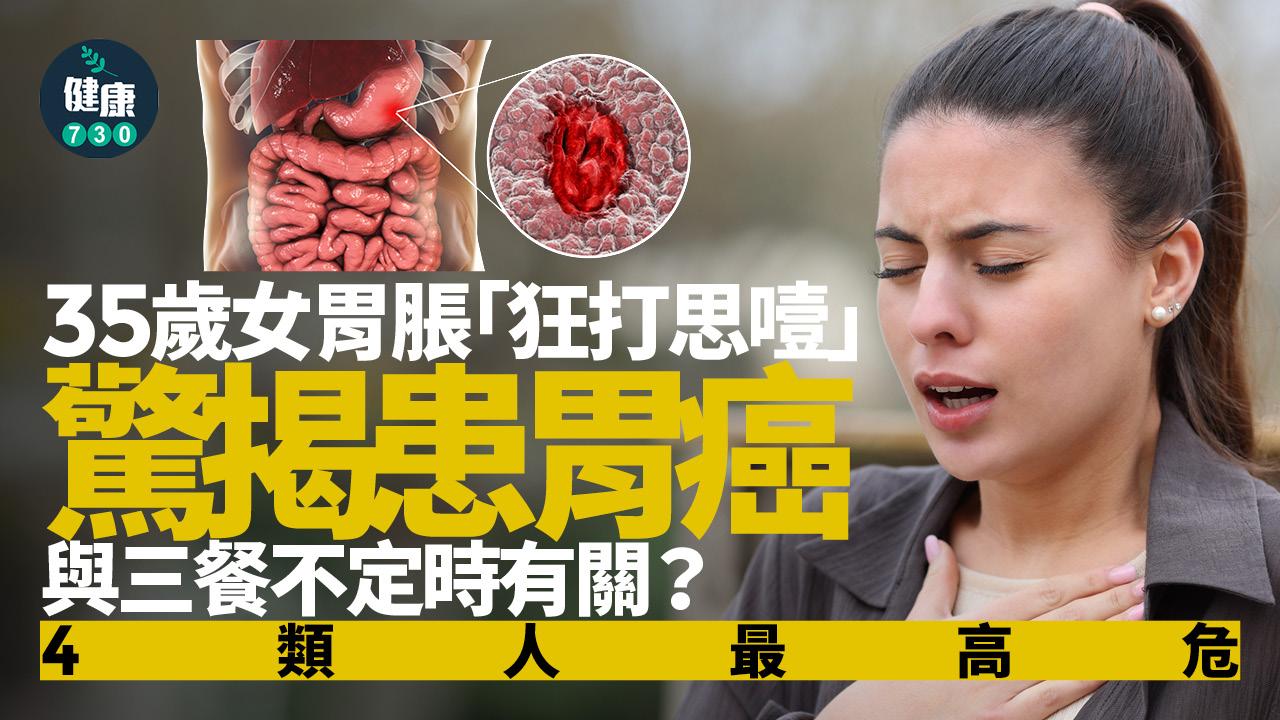 胃脹 打嗝 胃癌 癌症 三餐不定時 分化不良型胃癌