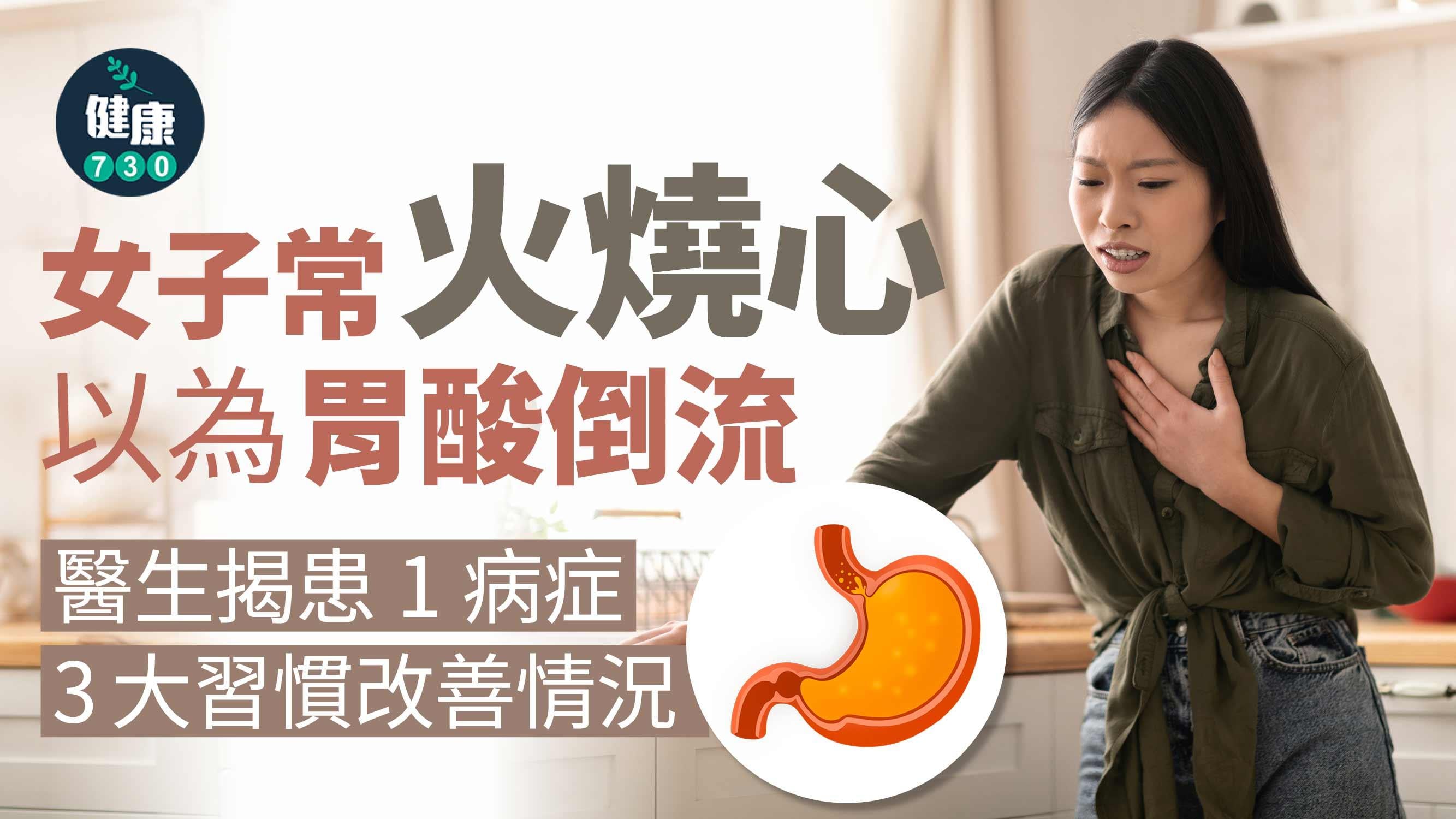 火燒心 胸口灼熱 胃酸倒流 胃酸 功能性火燒心 心口灼熱