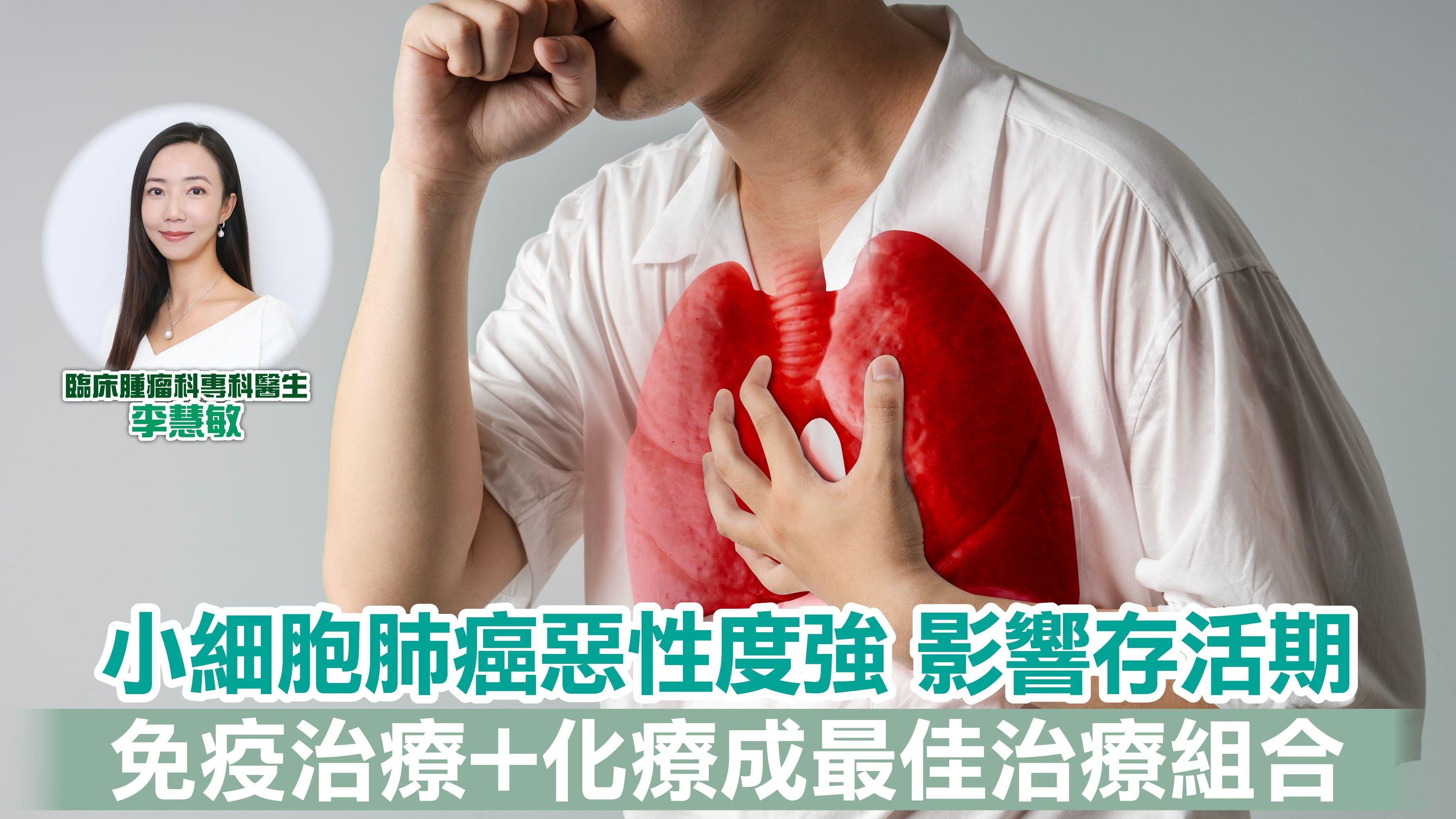 小細胞肺癌惡性度強 影響存活期 免疫治療+化療成最佳治療組合