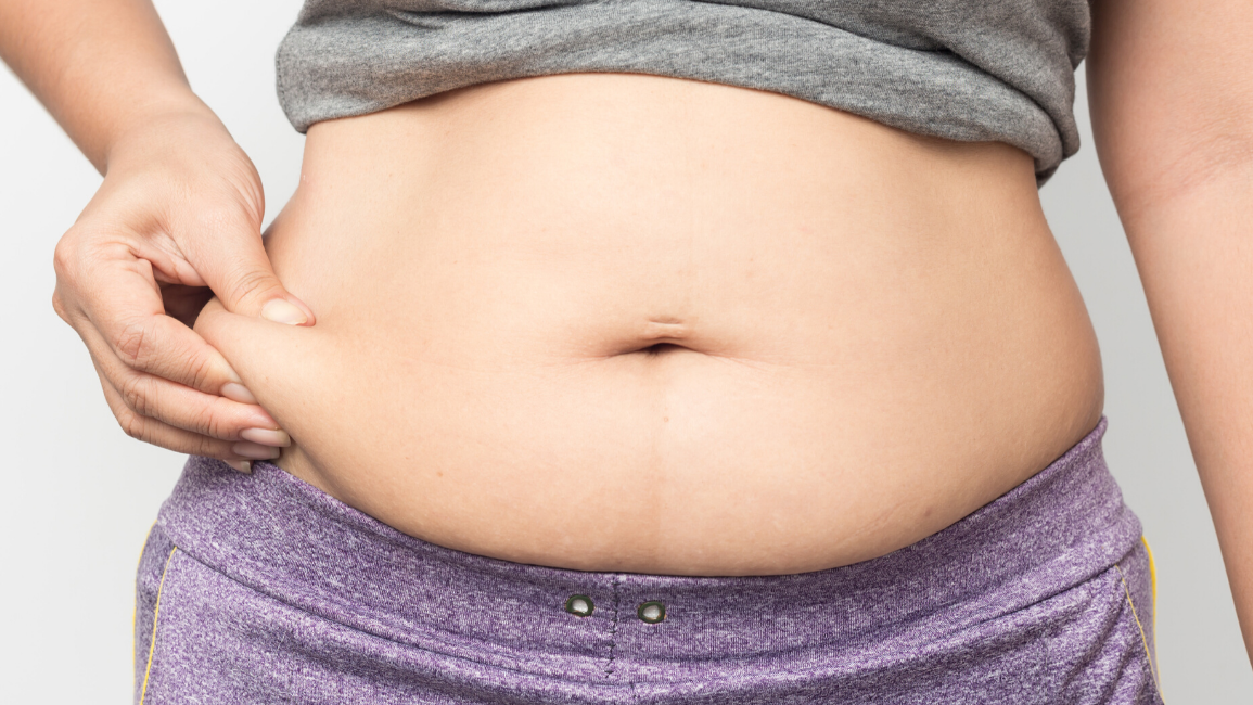 陳榮堅醫生強調，不論是脂肪型還是水腫型肥胖，改善循環才是根本，而促進循環最重要的關鍵在於「增加肌肉量」，日常簡單運動都有幫助。