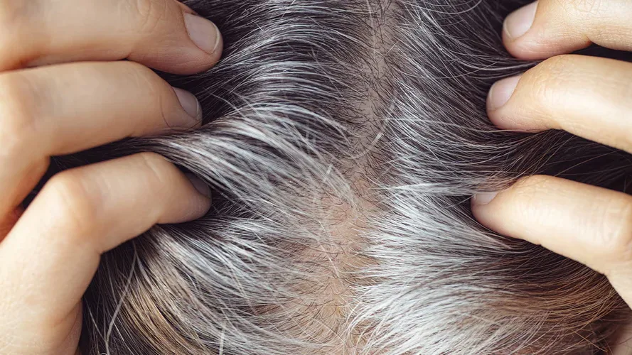 生白髮可能係好事？研究指頭髮變白反映內建抗癌機制有用