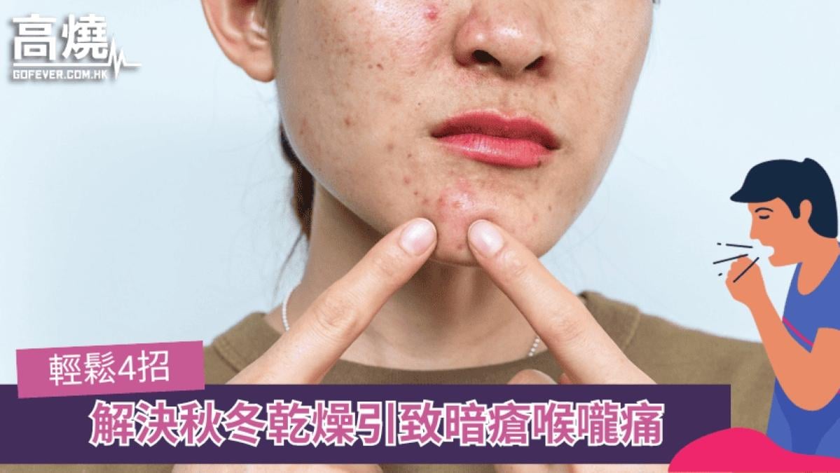 乾燥上火致暗瘡喉嚨痛　四大貼士助你降火