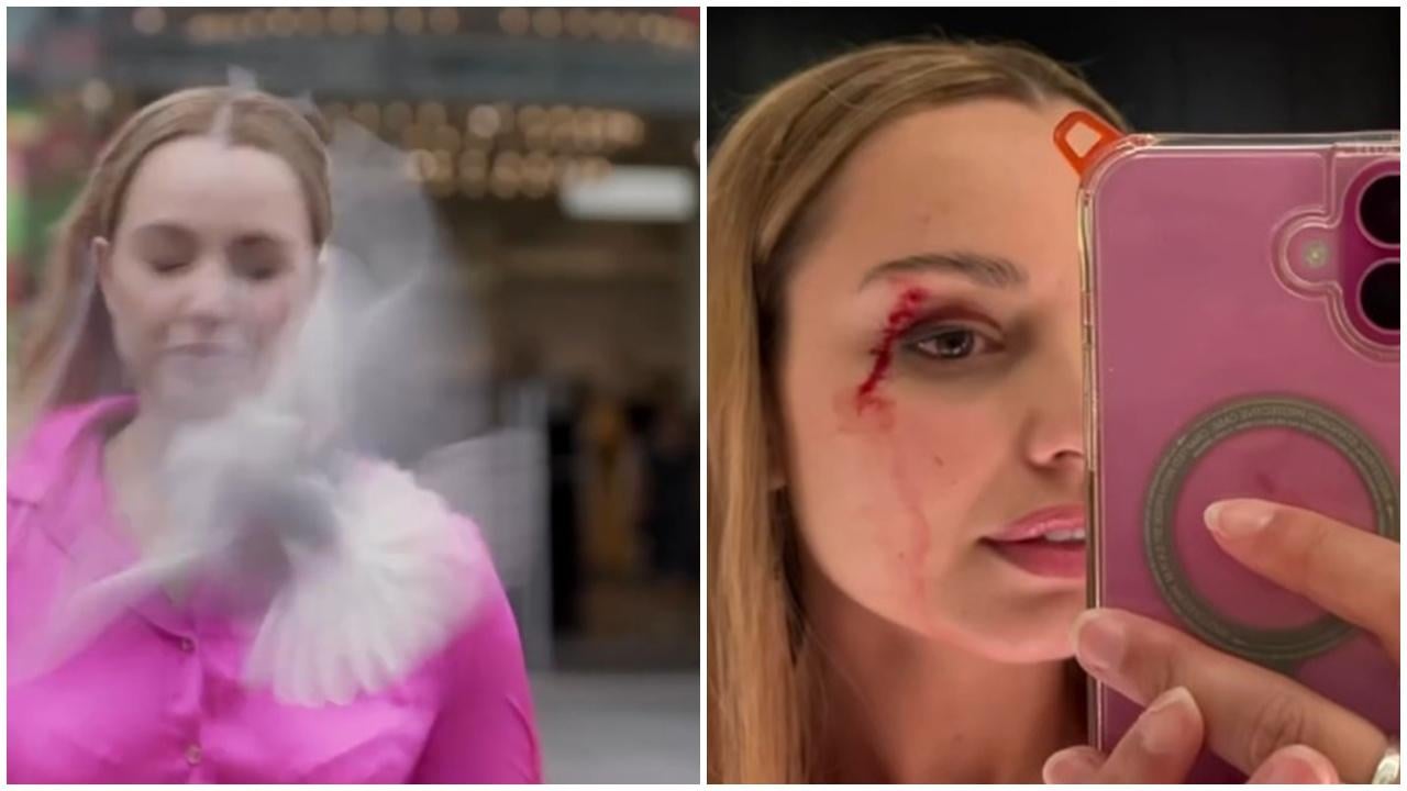 女記者出鏡遭海鷗俯衝兜巴掌，當場破相眼角濺血。(IG)