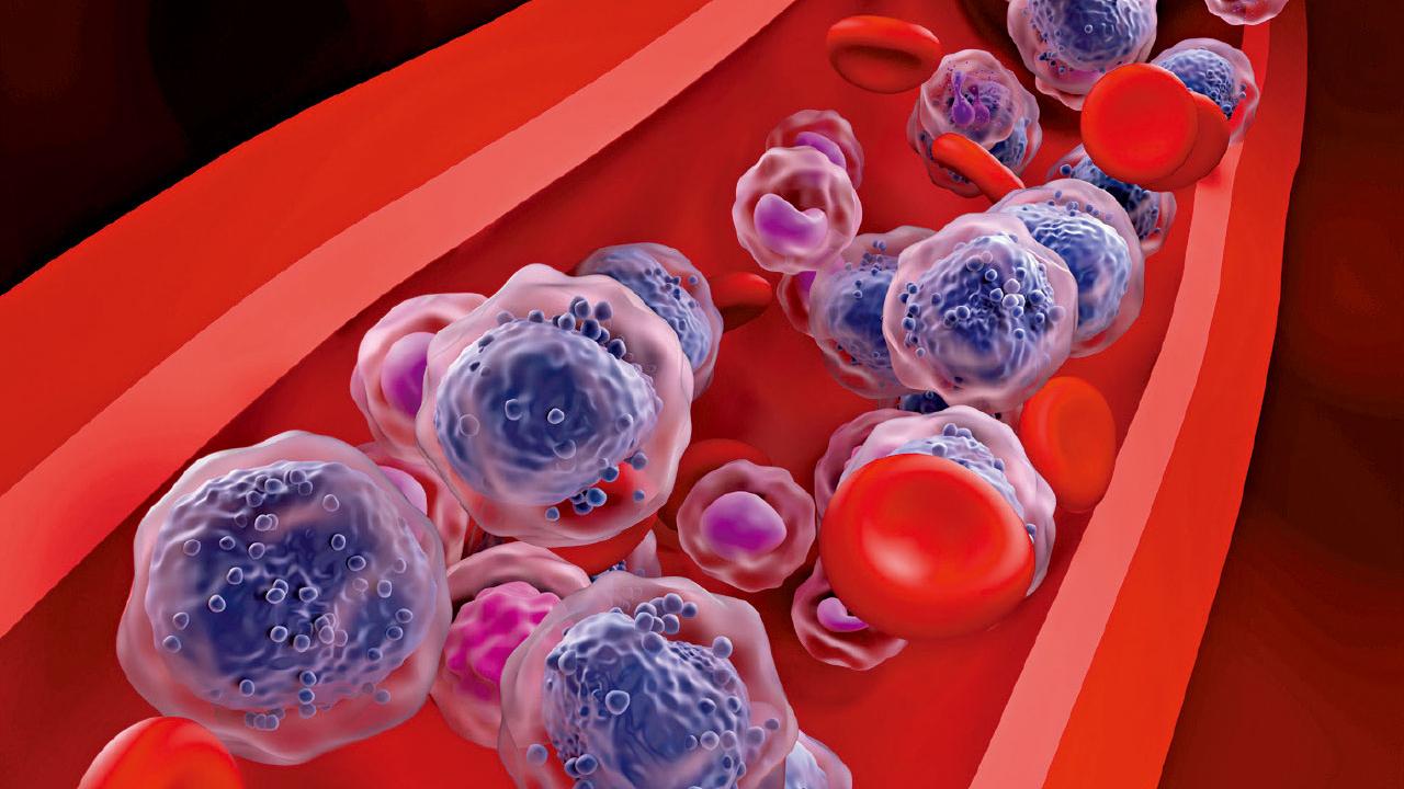 血癌致發燒疲倦 易誤認感冒貧血