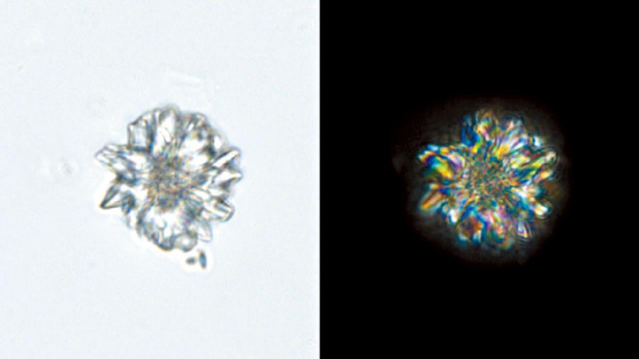 一招快速鑑定五加皮 顯微鑑定提升中藥安全