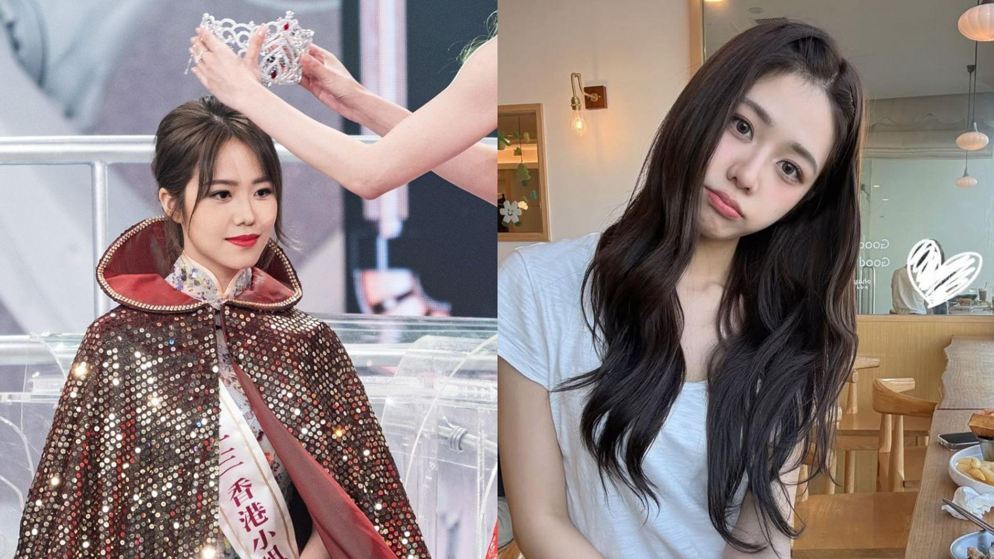 莊子璇曬靚相被指容貌再升級 鼻樑異常挺直