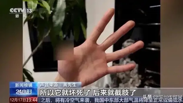 醫生指出，「異寵」可能攜帶細菌、寄生蟲等病原體。（示意圖／翻攝《央視網》）