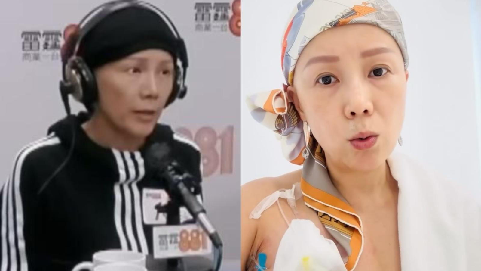 吳文忻自爆抗癌經歷曾住院16日 一起身擘大眼就痛