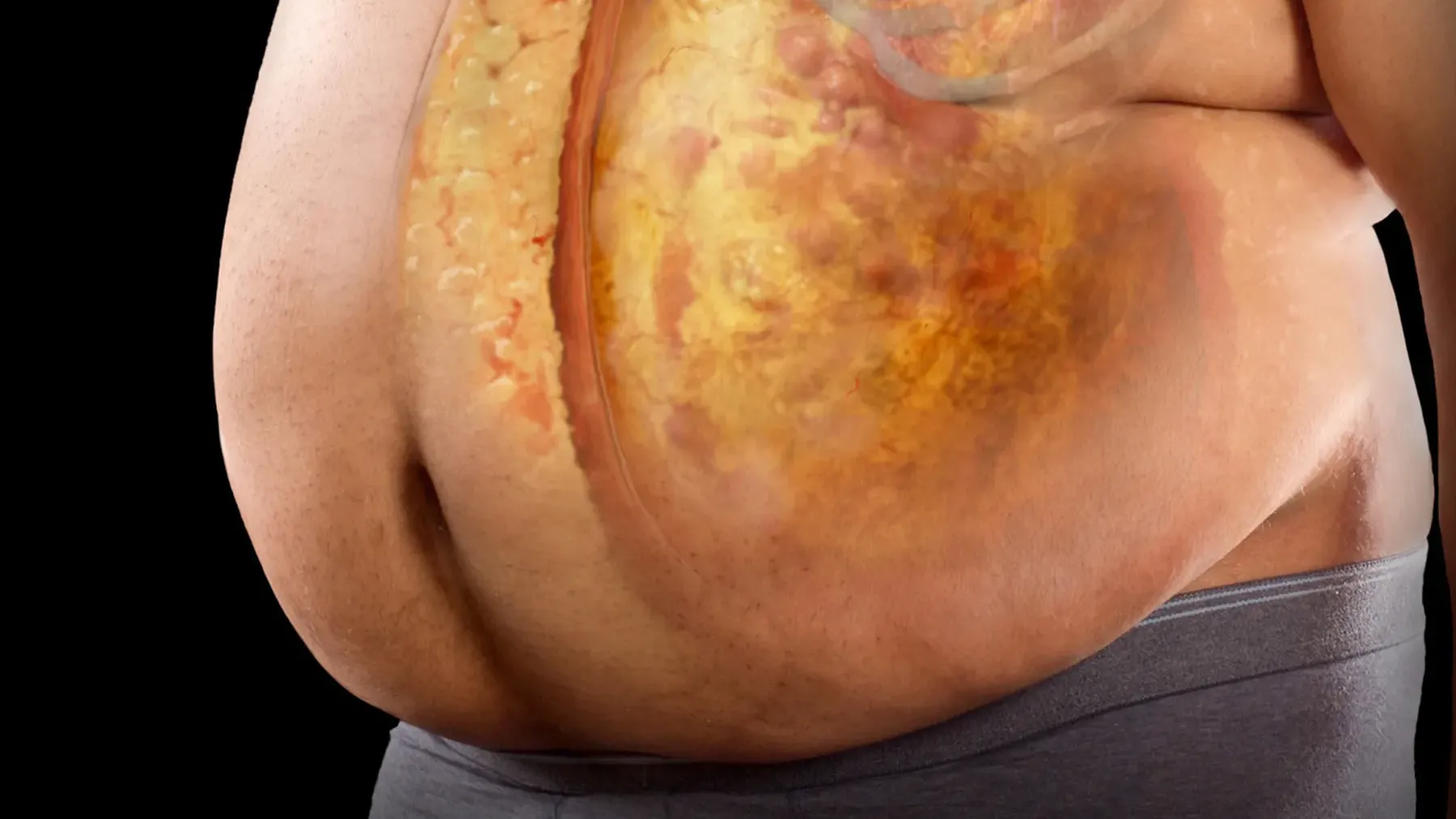 對抗中年發福 5招快速減內臟脂肪