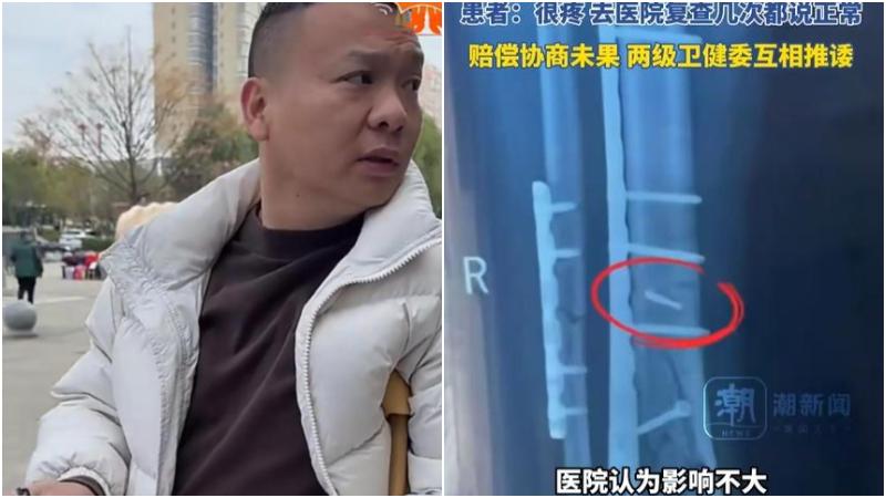 湖南一間醫院將手術鑽頭遺留於兩名病患體內後竟選擇隱瞞。（圖／翻攝《潮新聞》）