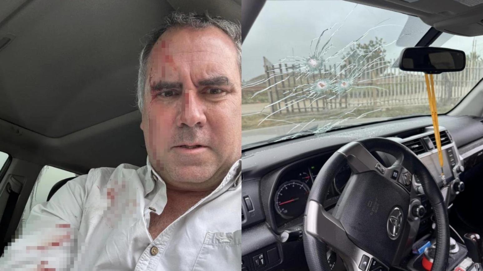 秘魯總統候選人貝勞德聲稱被槍擊　狂開12槍反擊脫險