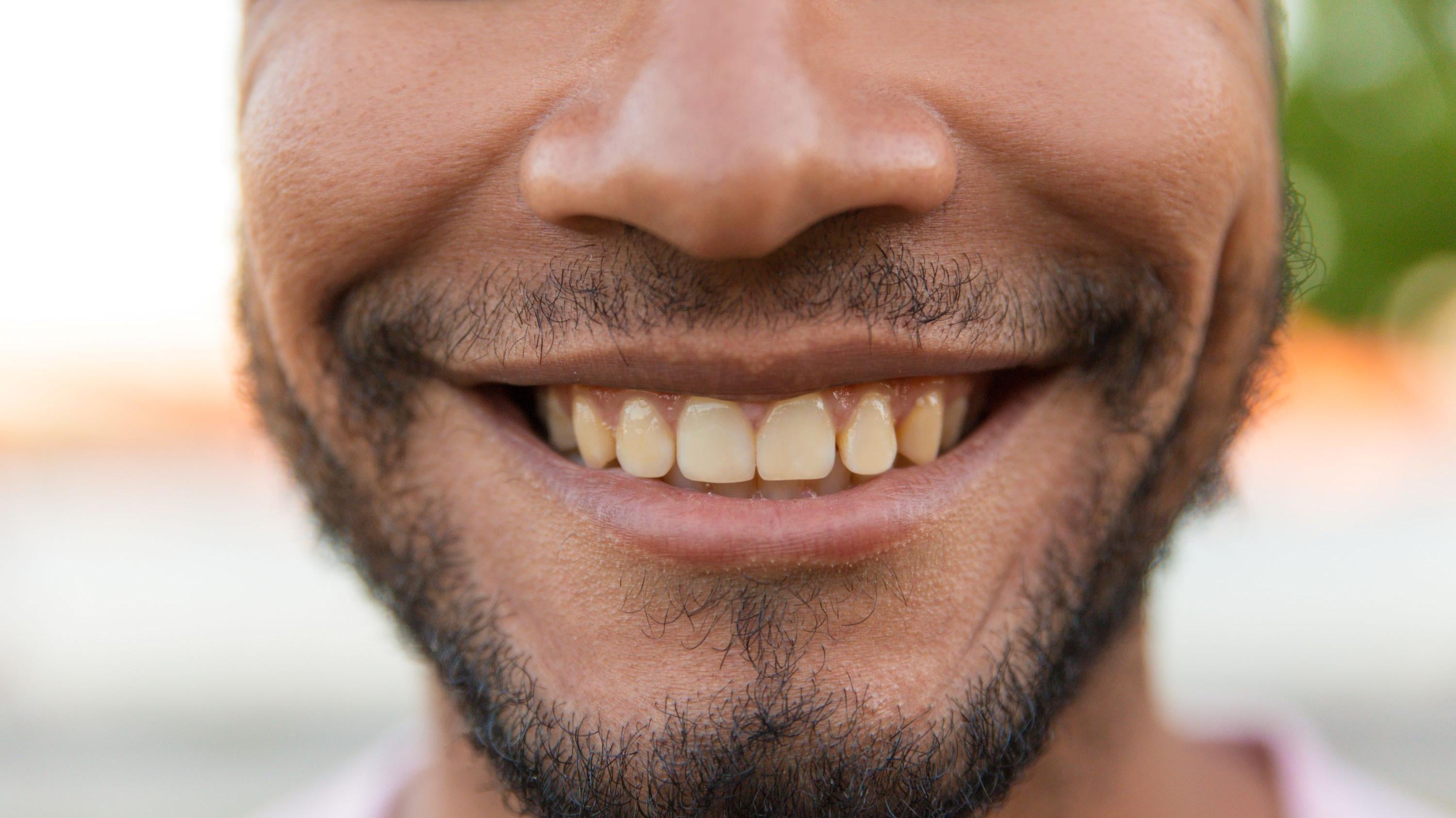 4個導致牙齒變黃的原因 你中咗幾多個？