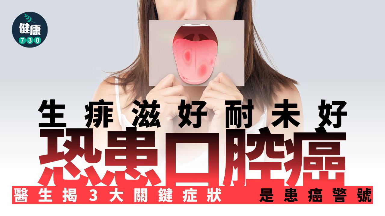 口腔潰瘍 癌症 口腔癌 生痱滋 口腔