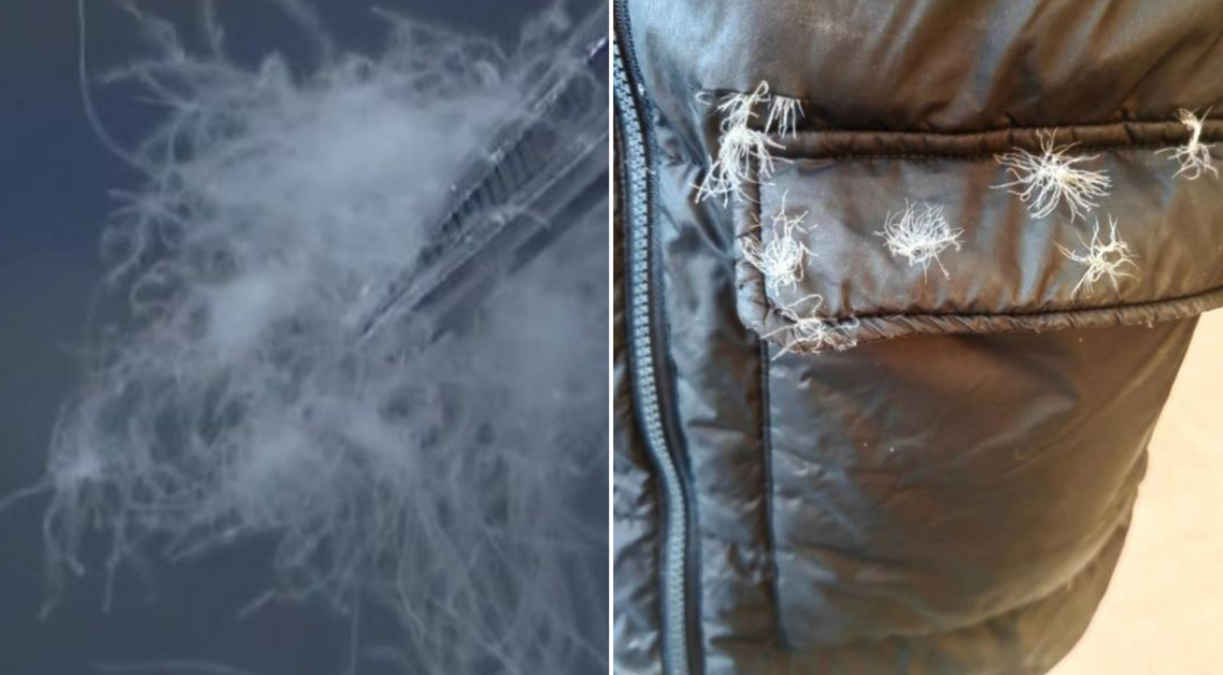 福建一名男子因每天穿從網購平台購入的平價破損羽絨服超過12小時，導致吸入羽絨微粒引發過敏性肺炎，甚至出現呼吸衰竭。   (網上圖片)