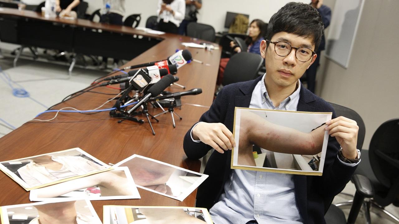 羅冠聰機場遇襲案 再有1名男子被捕