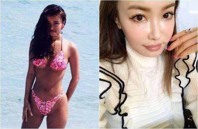 【即時娛樂】平子理沙被整容醫話「怪獸嘴」 