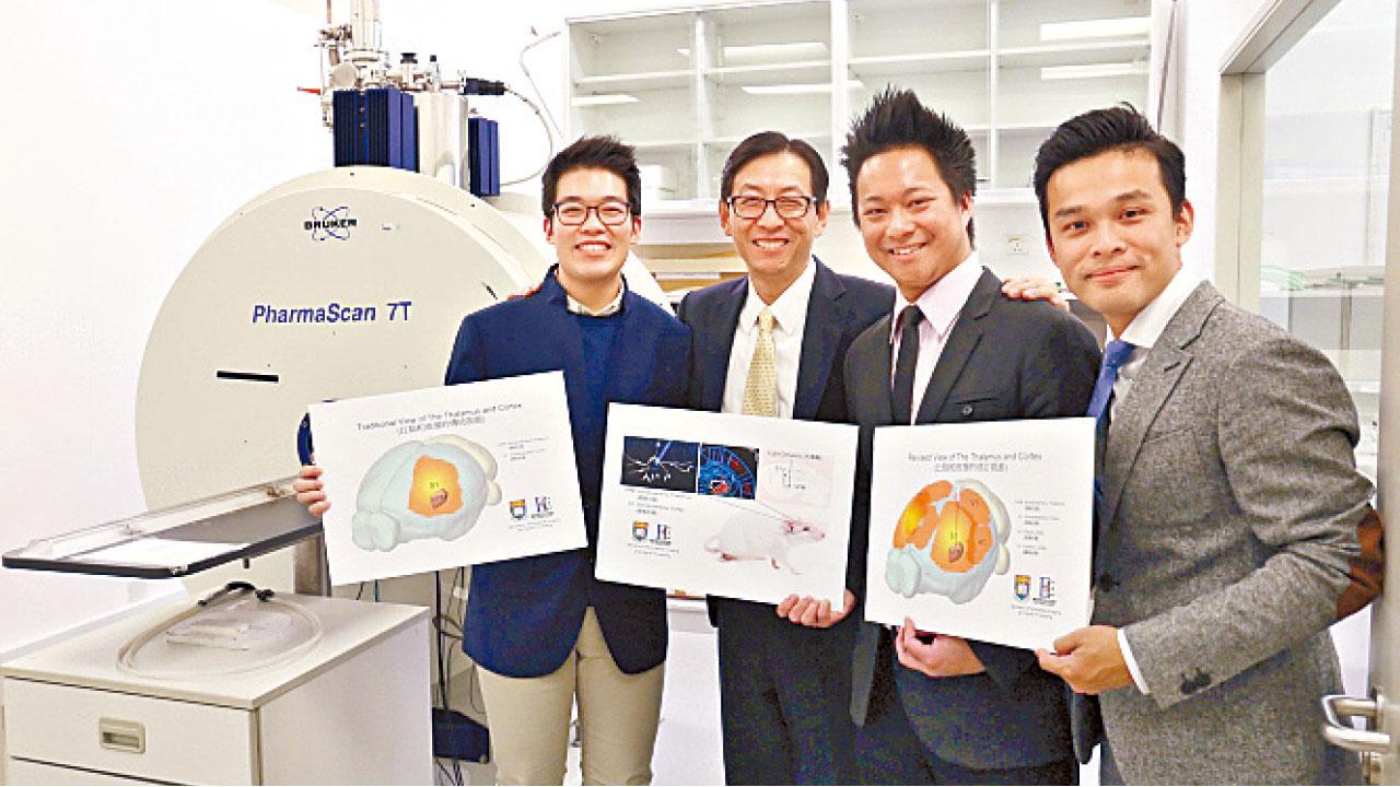 有助探索病因及治療方案 港大研究：新技術了解腦神經