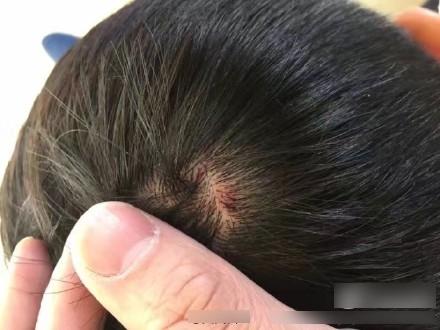 麗江再有遊客食飯被毆 惡店主侍應遭拘