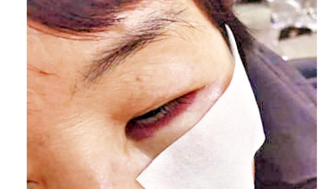 天降防毒面具 穗婦臉部砸傷吐血