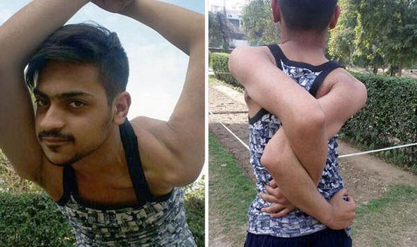 巴國「軟骨男」 膊頭360度屈埋無難度(有片)