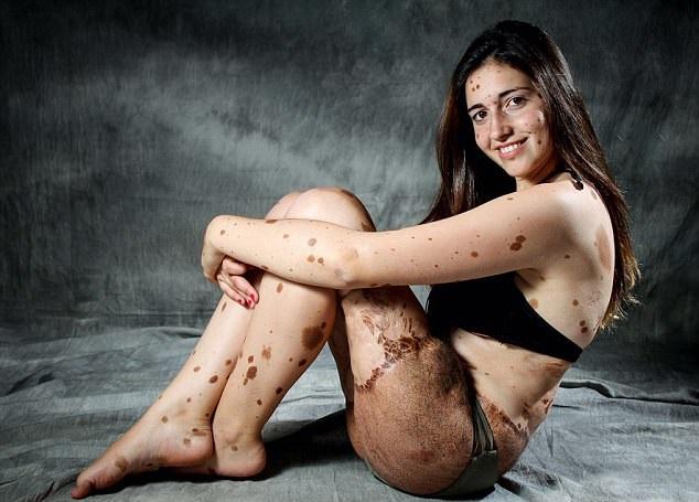 501斑點人脫穎而出