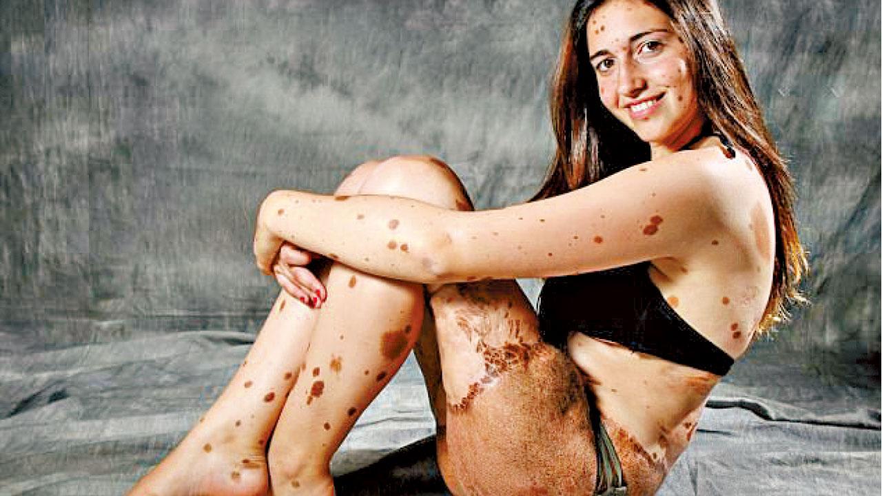 501斑點人 脫穎而出