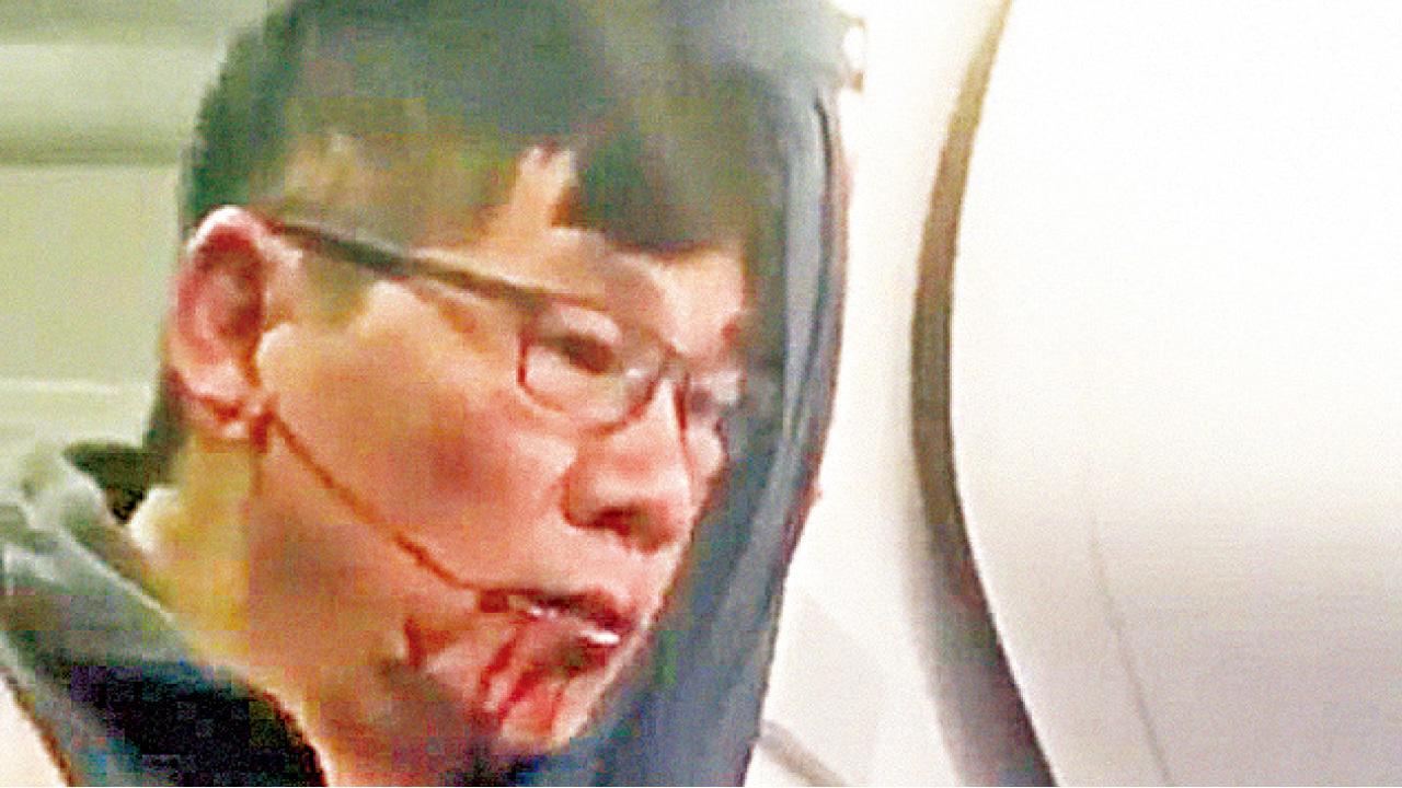 聯合航空華裔客遭強拖落機滿口鮮血 全球怒轟