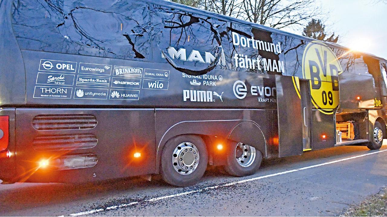 德甲勁旅多蒙特 隊巴遇襲   球星馬斯巴查 骨折碎片插臂