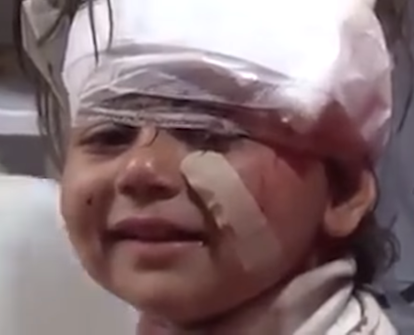 令人心酸  敘女童遇襲傷頭揚起天真爛漫笑臉 (有片)