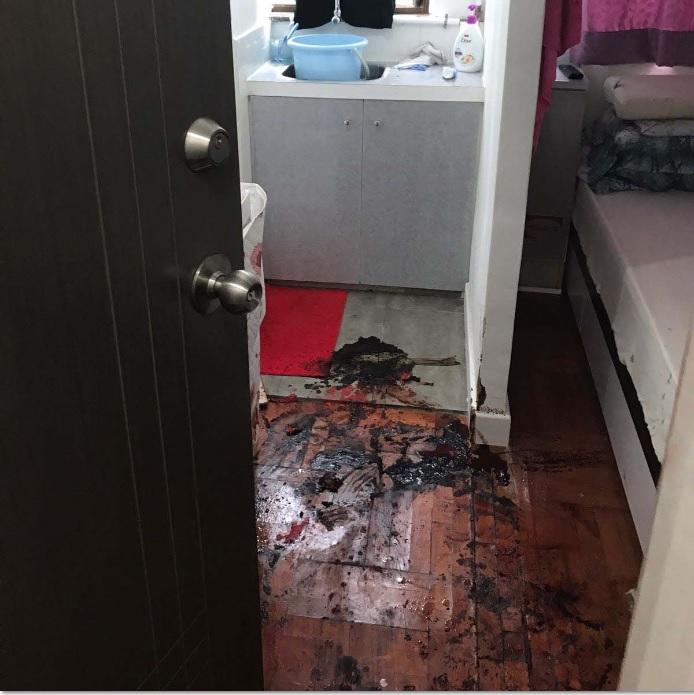 足浴店女店東遭潑鏹刀刺情況危殆