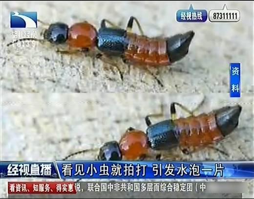 女子睡夢中拍死隱翅蟲 睡醒臉頸長滿化膿紅斑