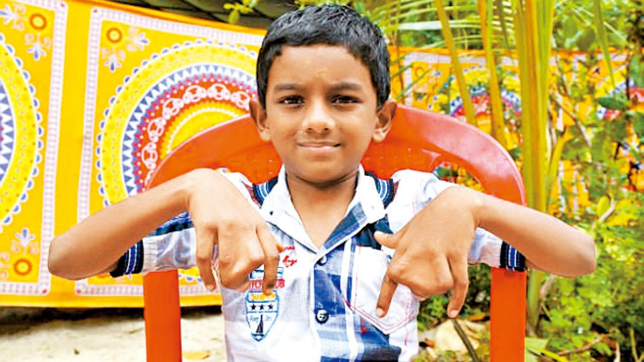 蹼指家族甘受詛