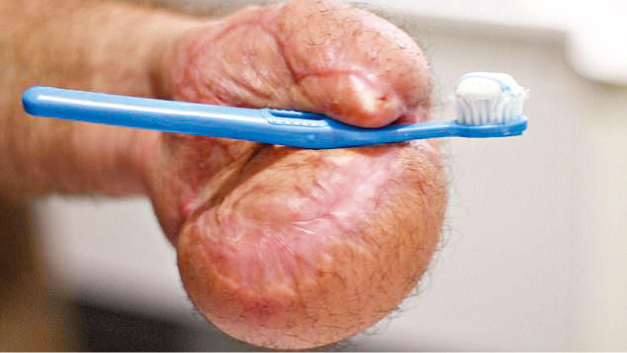 先鋒手術免截肢  腹中養掌功能再生