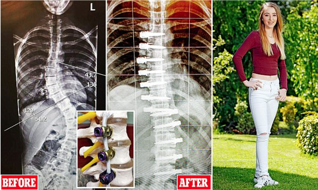 S脊美少女 尼龍繩拉直