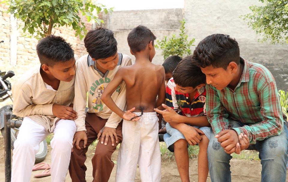 印度8歲男童腰後長「尾巴」 被奉為猴神轉世