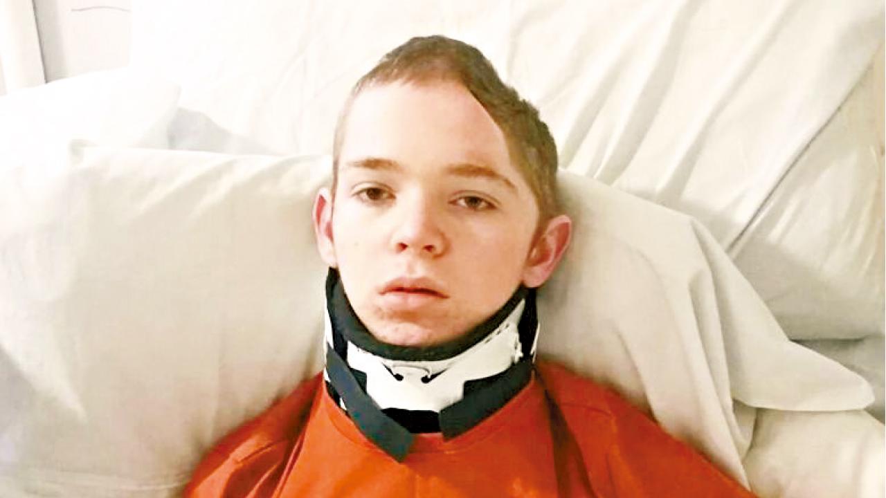 少年遭撞至頭骨削半  心碎母公開照片痛斥醉駕