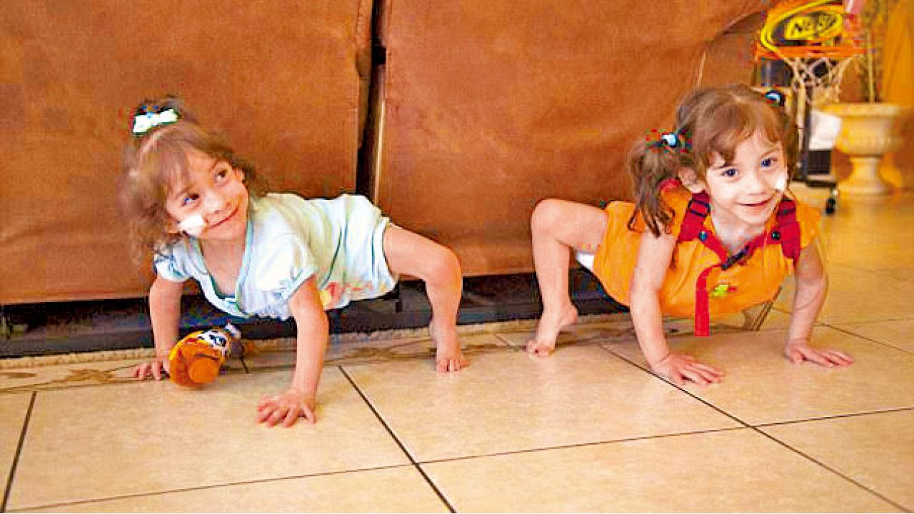 二人三足 分割獨腿闖新生