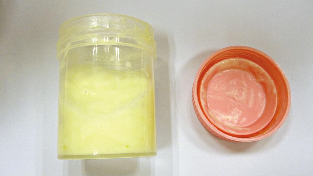 再有中醫處方含西藥藥膏