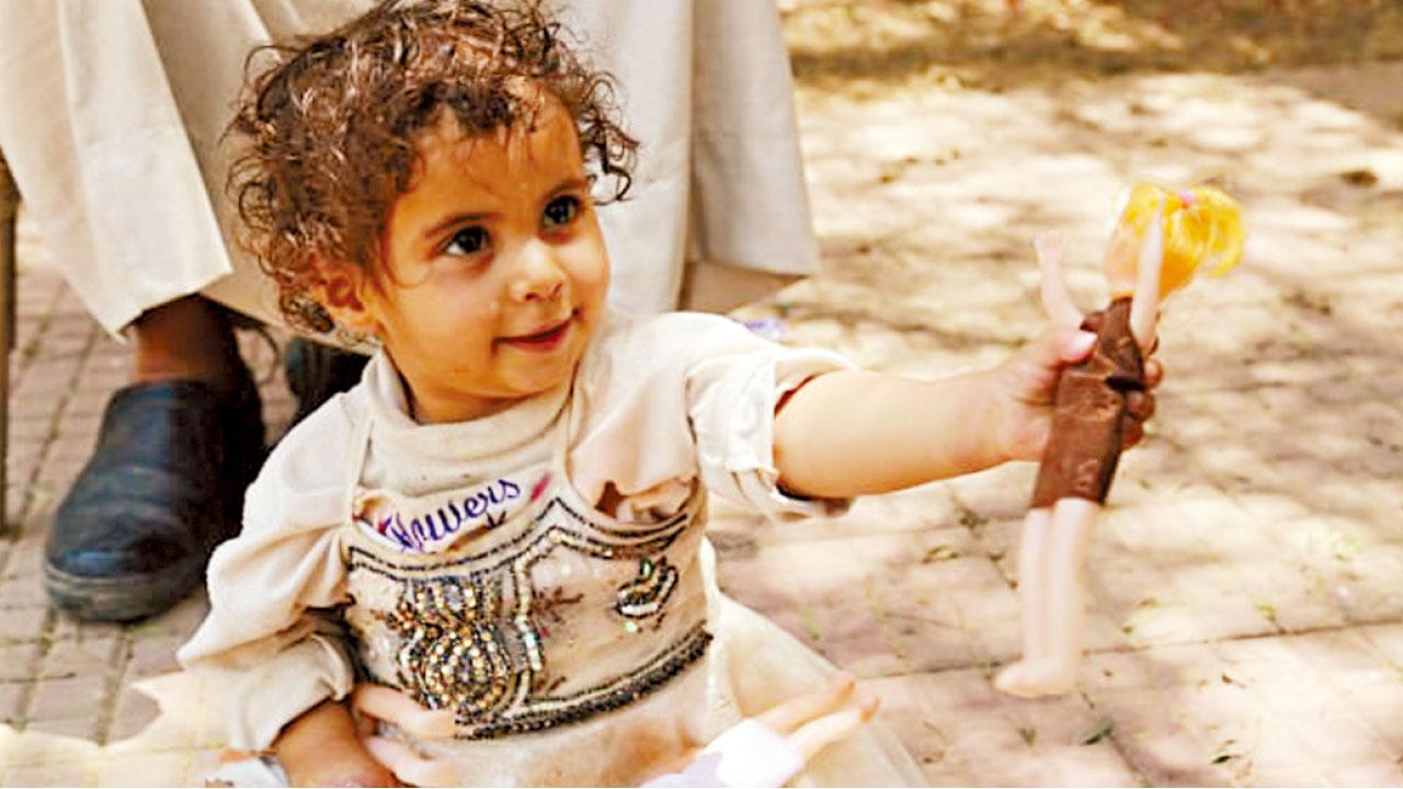 空襲命危需截4指 一歲女康復再現笑容