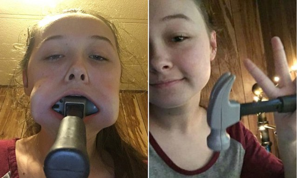 鎚仔塞口受乜刺激