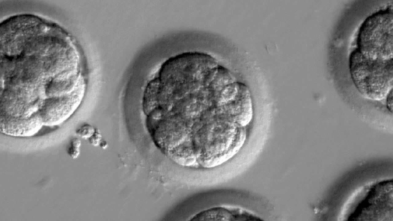 編輯基因大突破   首人類胚胎改基因治心臟病