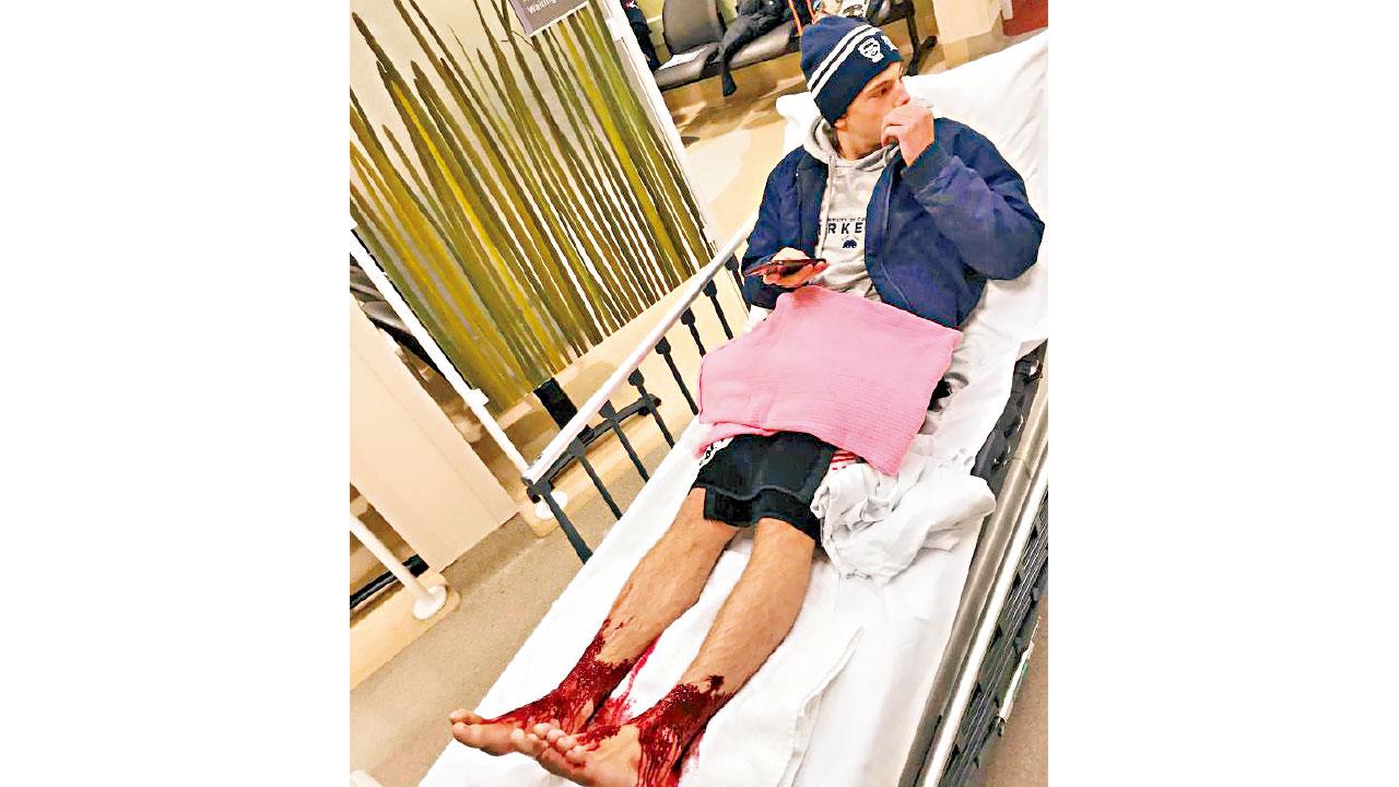 疑被海蝨咬出數百傷口 澳少年沙灘浸腳流血不止