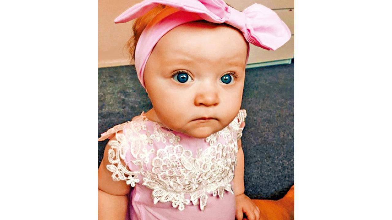 赤足行沙灘 疑踩狗尿感染 女嬰拇趾腫脹險須切除