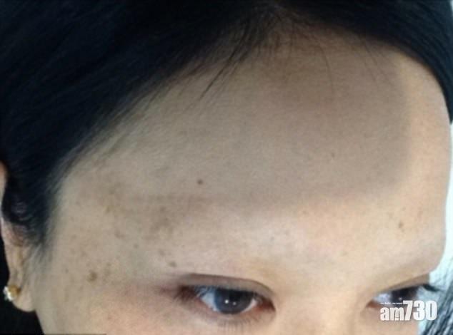 紋眉災難變光禿