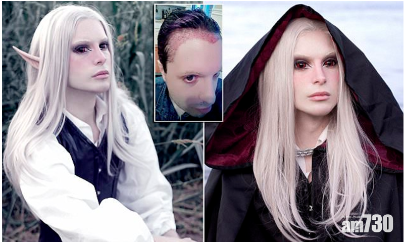 精靈整容怪  再添美人尖