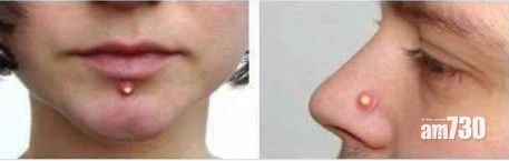 仿含膿暗瘡鼻環 網民大叫好核突