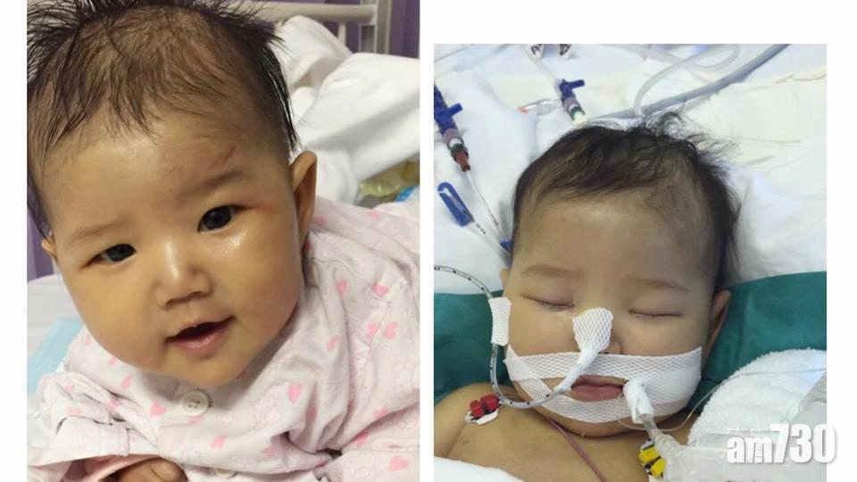 女童患先天性膽管閉鎖 母捐肝失敗求助善心人