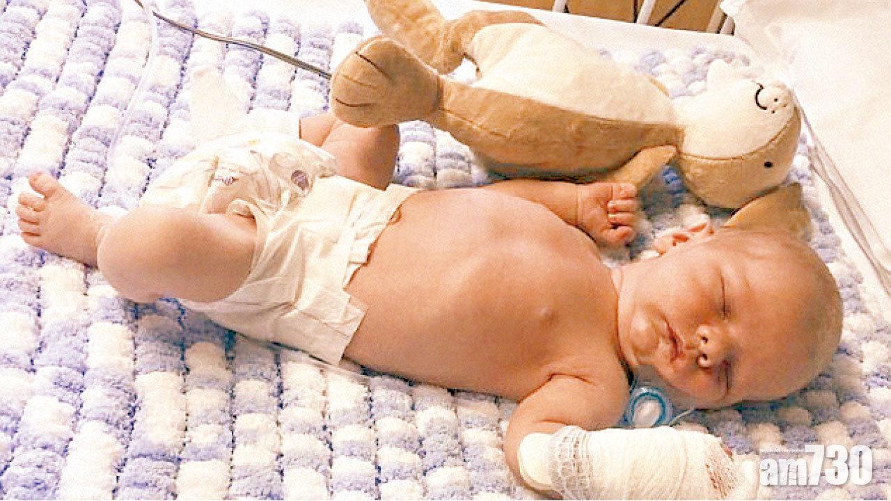 母親一吻 9日大愛兒染腦膜炎